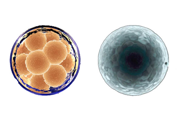 江门供卵试管助孕哪家机构号-试管婴儿专家：新鲜或冷冻胚胎移植--这取决于什么是适合你的